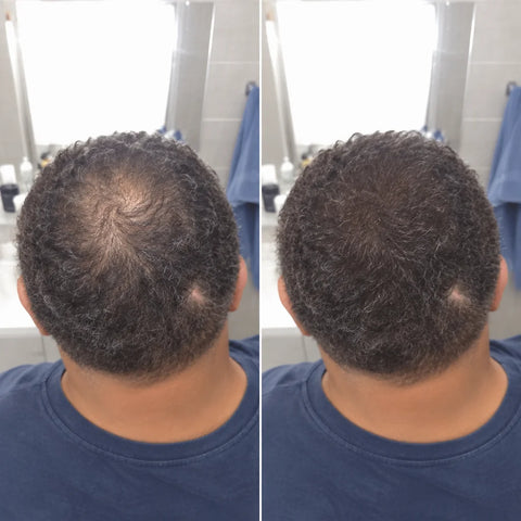 A square paired comparison made from two close customer's own photos placed side by side, with no la